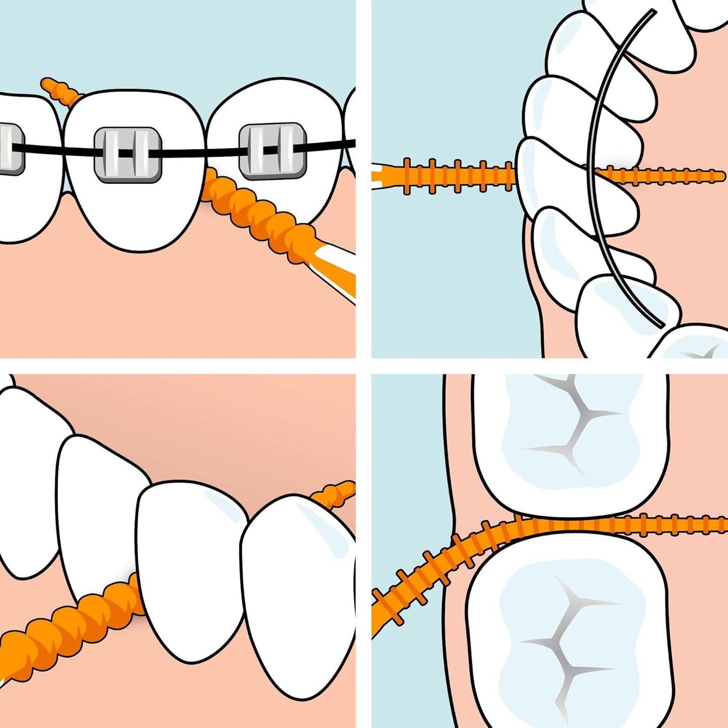 Effective plaque removal using TePe EasyPick for narrow teeth gaps