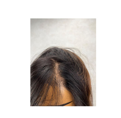 Adjustable lace front cap for comfort and secure fit