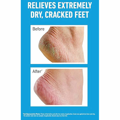 Foot repair cream for extremely dry skin