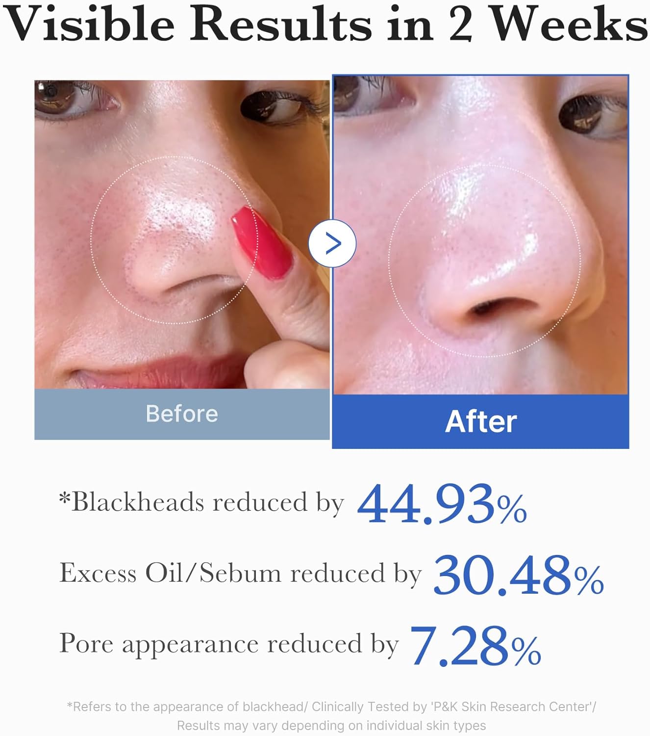 Dual sided toner pads for smoother skin texture